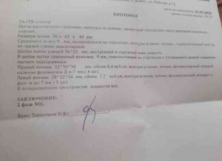 Узд після зб.