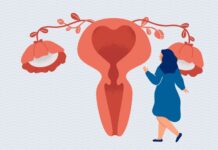 Perimenopauze: wat vrouwen van in de dertig en veertig moeten weten