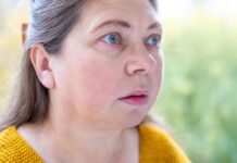 ІІ виявив побічні ефекти, які пропускають лікарі
