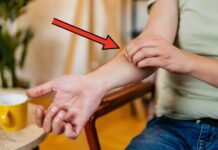 Гіпермобільність суглобів: як розпізнати симптоми та керувати станом