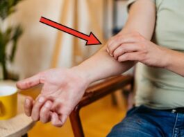 Гіпермобільність суглобів: як розпізнати симптоми та керувати станом