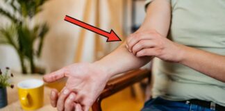Гіпермобільність суглобів: як розпізнати симптоми та керувати станом