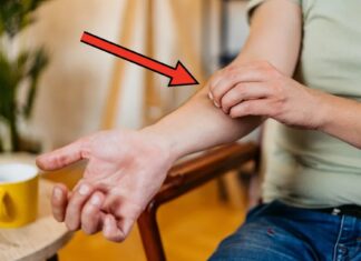 Гіпермобільність суглобів: як розпізнати симптоми та керувати станом